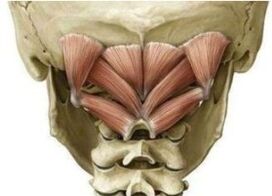 Deep muscles of the neck that hold the atlant in the wrong position